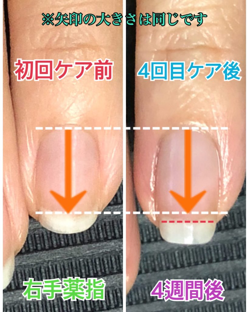 自爪のお手入れ専門サロン Pause ポーズ 摂津市 千里丘 自爪育成 手の病院サロン トラブルフットケア お爪と手肌の健康サロンpause ポーズ